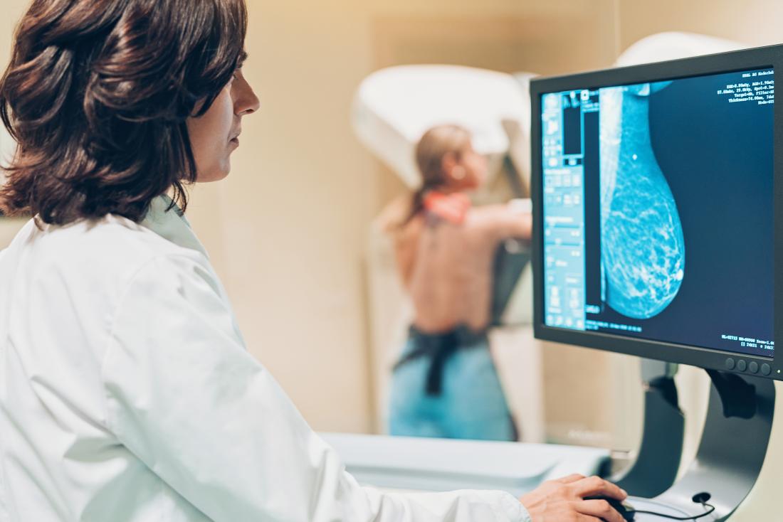 a doctor looking at results from a 3d mammogram